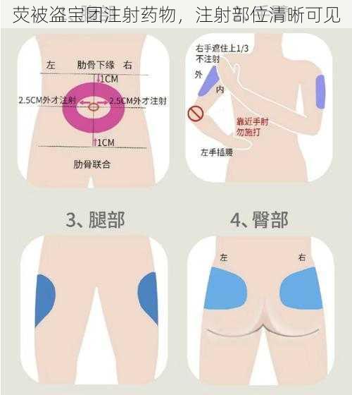 荧被盗宝团注射药物，注射部位清晰可见